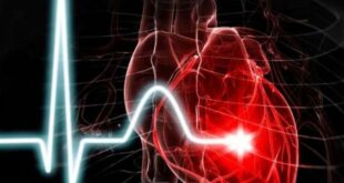 اكتشاف جامعة ساراتوف يقلل أخطاء تشخيص أمراض القلب بنسبة 50%